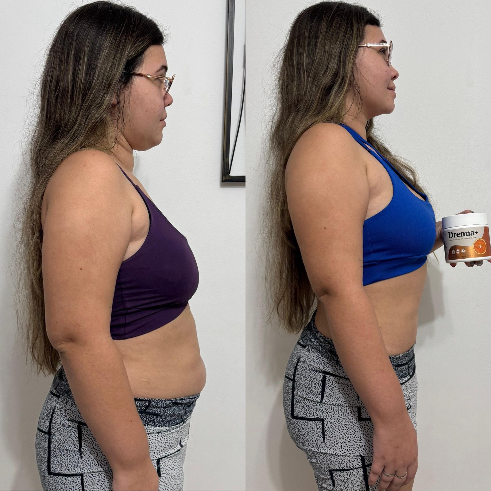 Antes e depois de perfil lateral de cliente com o Drenna+ — redução de barriga visível